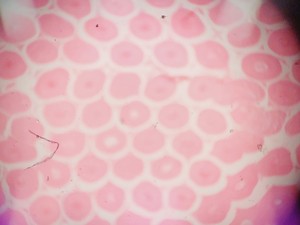 Thumbnail image of Leica DM LB2 Biological Microscope w/ 5 x Objectives N Plan 2.5x 5x 10x 20x Lab