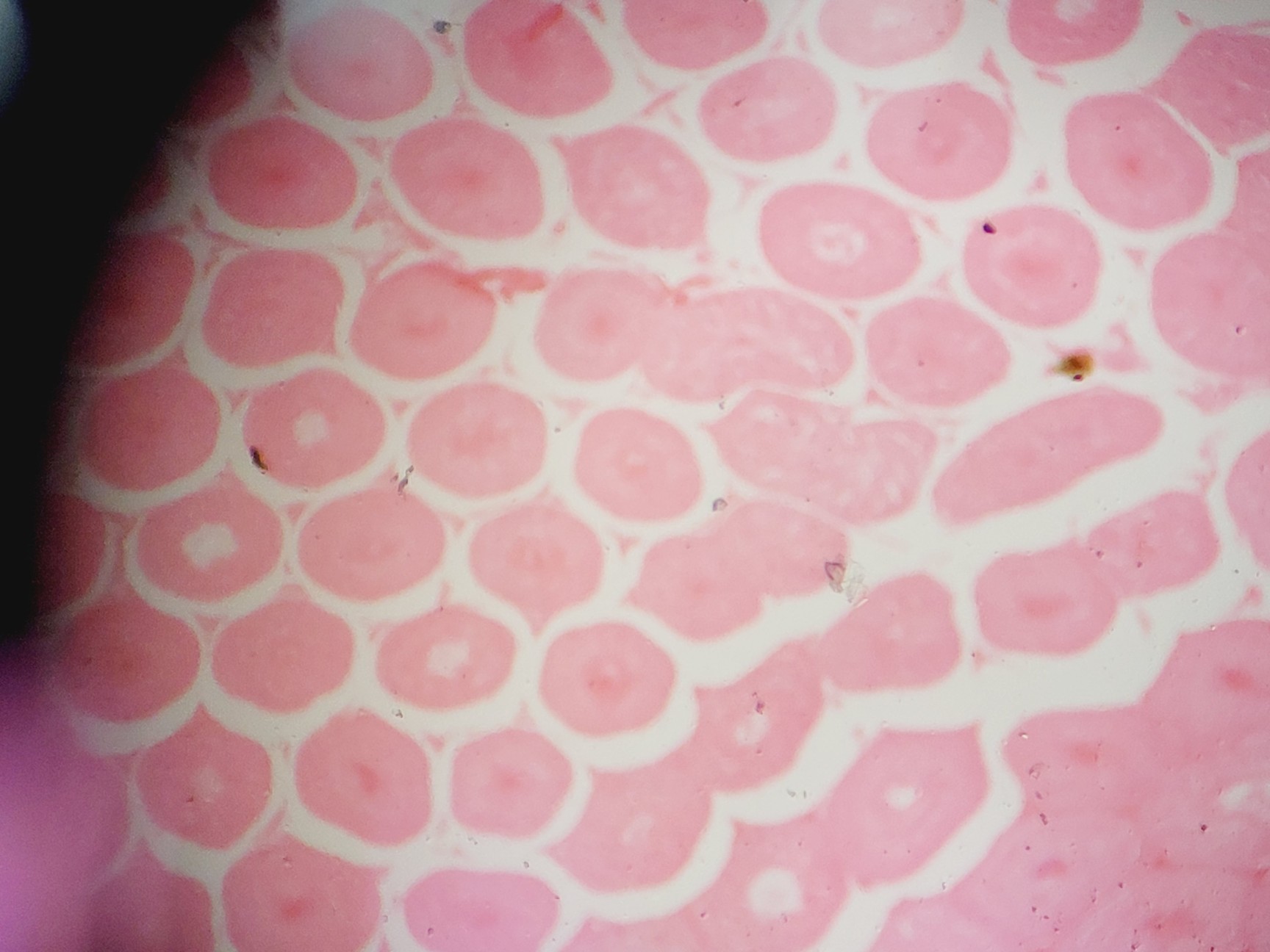 Image of Leica DM LB2 Biological Microscope w/ 5 x Objectives N Plan 2.5x 5x 10x 20x Lab