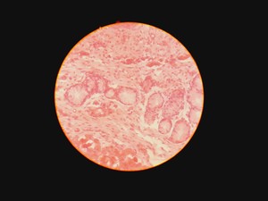 Thumbnail image of Leica Type 090-135.008-000 Inverted Microscope w/ 4 x Objectives 4x/10x/20x Lab