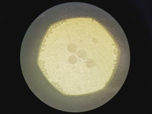Thumbnail image of Zeiss Axio Vert A1 Microscope w/ 5 x Objectives 5x/10x/20x/50x/100x & Software