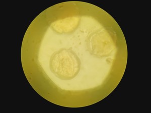 Thumbnail image of Zeiss Axio Vert A1 Microscope w/ 5 x Objectives 5x/10x/20x/50x/100x & Software