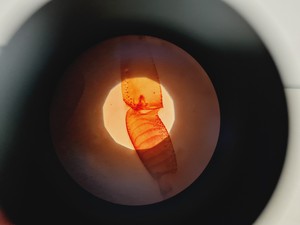 Thumbnail image of Kyowa Medilux-12 Binocular Microscope with 4 x Objectives Lab