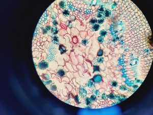 Thumbnail image of Zeiss AxioSkop 2  Microscope w/ 3 x Objectives 20/40/100x Lab