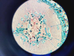 Thumbnail image of Zeiss AxioSkop 2  Microscope w/ 3 x Objectives 20/40/100x Lab