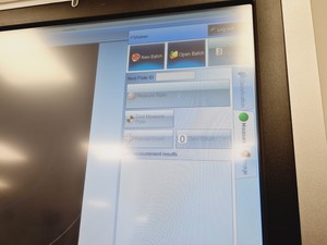 Thumbnail image of Protocol 3 SynBioSis Colony Counter Lab