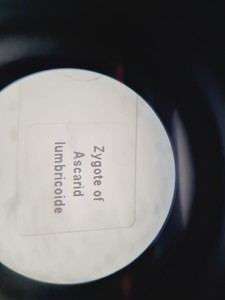 Thumbnail image of Carl Zeiss Surgical Microscope + Metz NAG 80 VA Controller Spares/Repair Lab