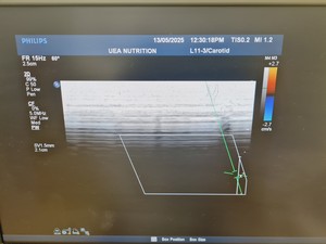 Thumbnail image of Philips iE33 xMATRIX Ultrasound System w/ Sony Digital Graphic Printer UP-D897 