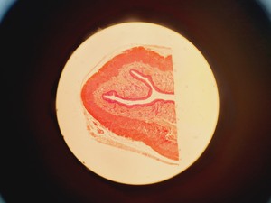 Thumbnail image of Nikon YS100 Biological Microscope w/ 4 x Objectives - 4/10/40/100x Oil Lab