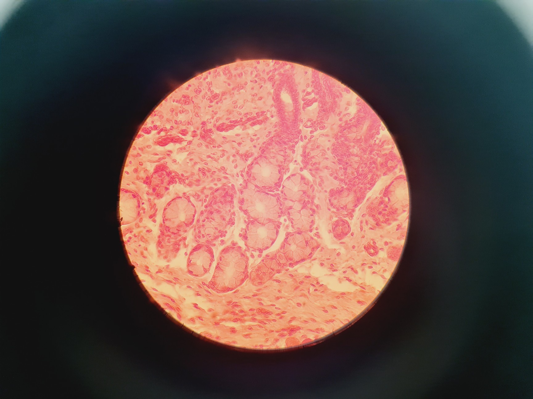 Image of Nikon YS100 Biological Microscope w/ 4 x Objectives - 4/10/40/100x Oil Lab