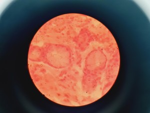 Thumbnail image of Nikon YS100 Biological Microscope w/ 4 x Objectives - 4/10/40/100x Oil Lab