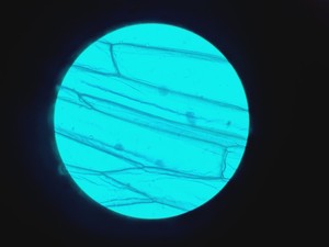 Thumbnail image of Leitz Wetzlar 786496 Microscope w/ 5 x Objectives Lab