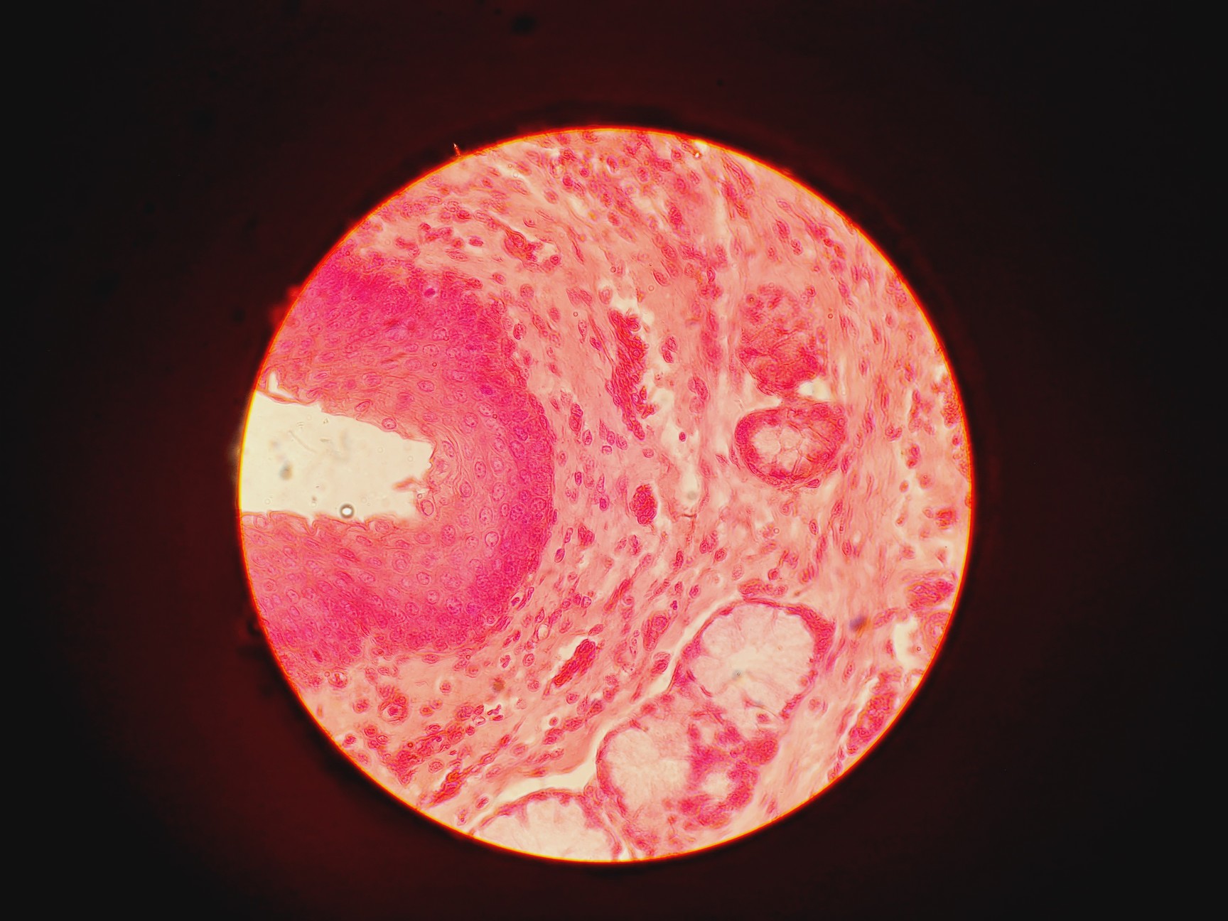 Image of Leitz Wetzlar 786496 Microscope w/ 5 x Objectives Lab