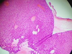 Thumbnail image of VWR BL124A Brightfield Microscope 4 x Optika Objectives 4/10/40/100x Lab