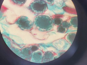Thumbnail image of Nikon Eclipse TE2000-U Microscope W/ 3 x Objectives & PSU Spares/Repair Lab