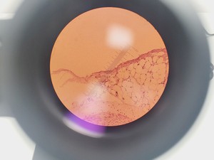 Thumbnail image of Olympus CH-2 Compound Microscope with 4 x Objectives 4 10 20 40x Lab