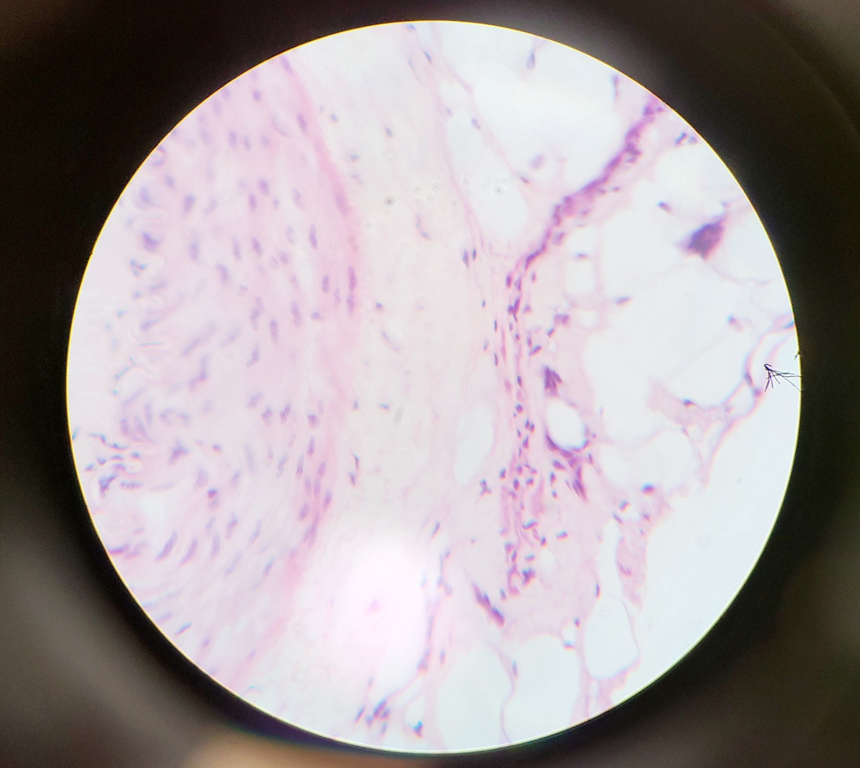 Image of Olympus BH-2 Compound Microscope w/ 5x Objectives DPlan SPlan A10PL Lab