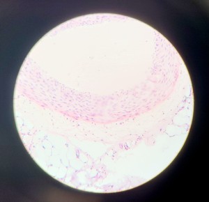 Thumbnail image of Olympus BH-2 Compound Microscope w/ 5x Objectives DPlan SPlan A10PL Lab