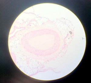 Thumbnail image of Olympus BH-2 Compound Microscope w/ 5x Objectives DPlan SPlan A10PL Lab