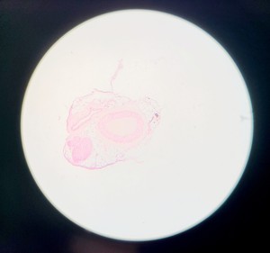 Thumbnail image of Olympus BH-2 Compound Microscope w/ 5x Objectives DPlan SPlan A10PL Lab