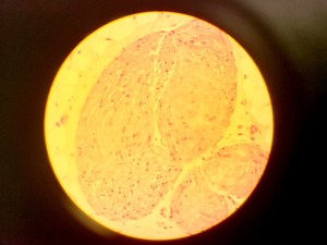 Thumbnail image of Olympus BH-2 Compound Microscope w/ 5x Objectives DPlan SPlan A10PL