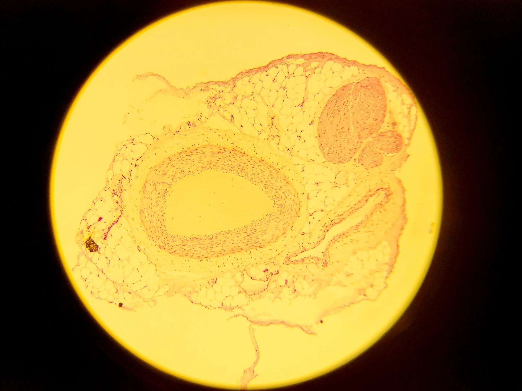 Image of Olympus BH-2 Compound Microscope w/ 5x Objectives DPlan SPlan A10PL