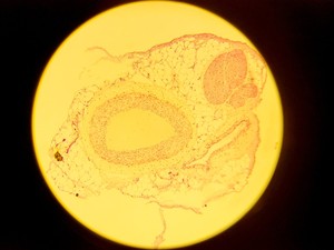 Thumbnail image of Olympus BH-2 Compound Microscope w/ 5x Objectives DPlan SPlan A10PL