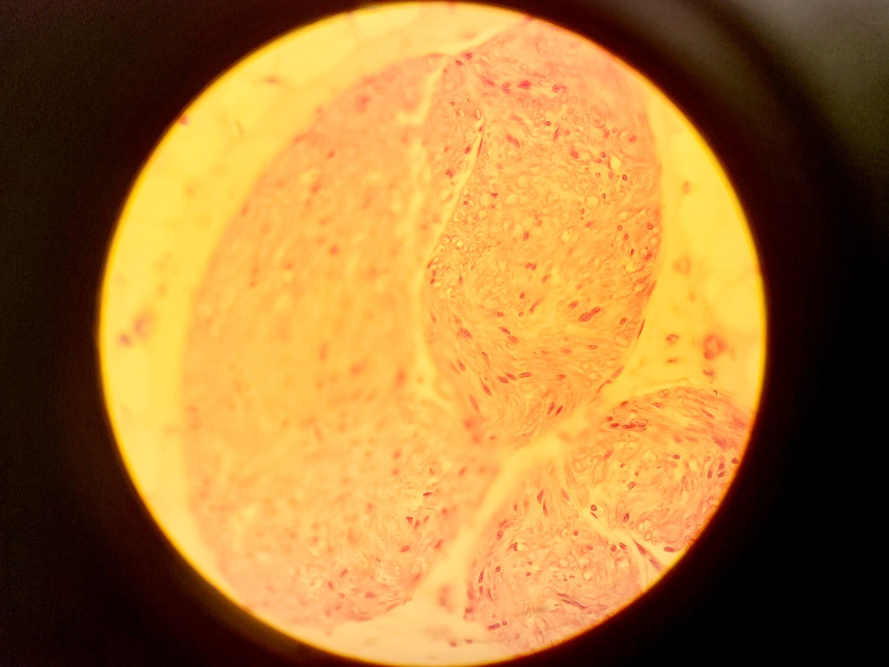 Image of Olympus BH-2 Compound Microscope w/ 5x Objectives DPlan SPlan A10PL