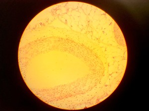 Thumbnail image of Olympus BH-2 Compound Microscope w/ 5x Objectives DPlan SPlan A10PL