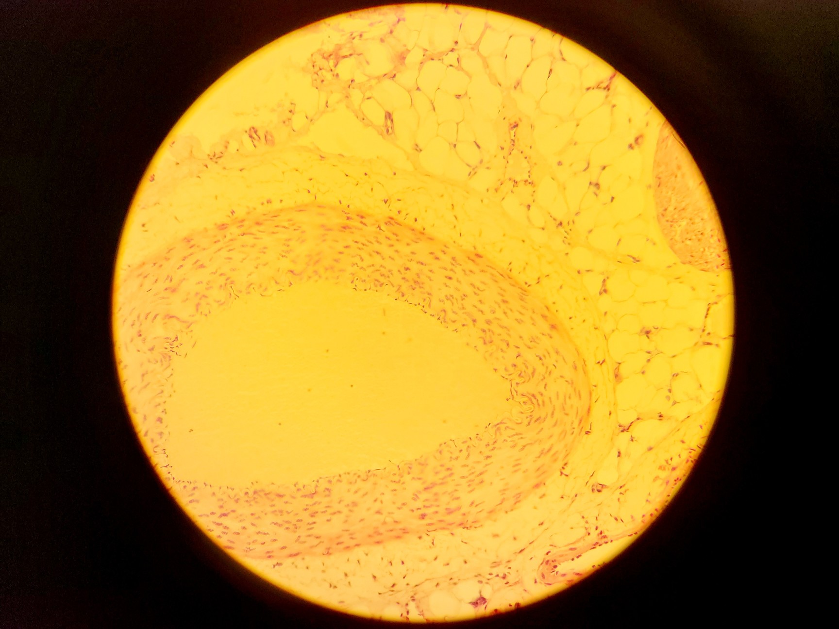 Image of Olympus BH-2 Compound Microscope w/ 5x Objectives DPlan SPlan A10PL
