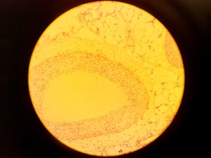 Thumbnail image of Olympus BH-2 Compound Microscope w/ 5x Objectives DPlan SPlan A10PL