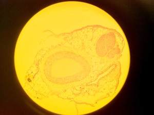 Thumbnail image of Olympus BH-2 Compound Microscope w/ 5x Objectives DPlan SPlan A10PL