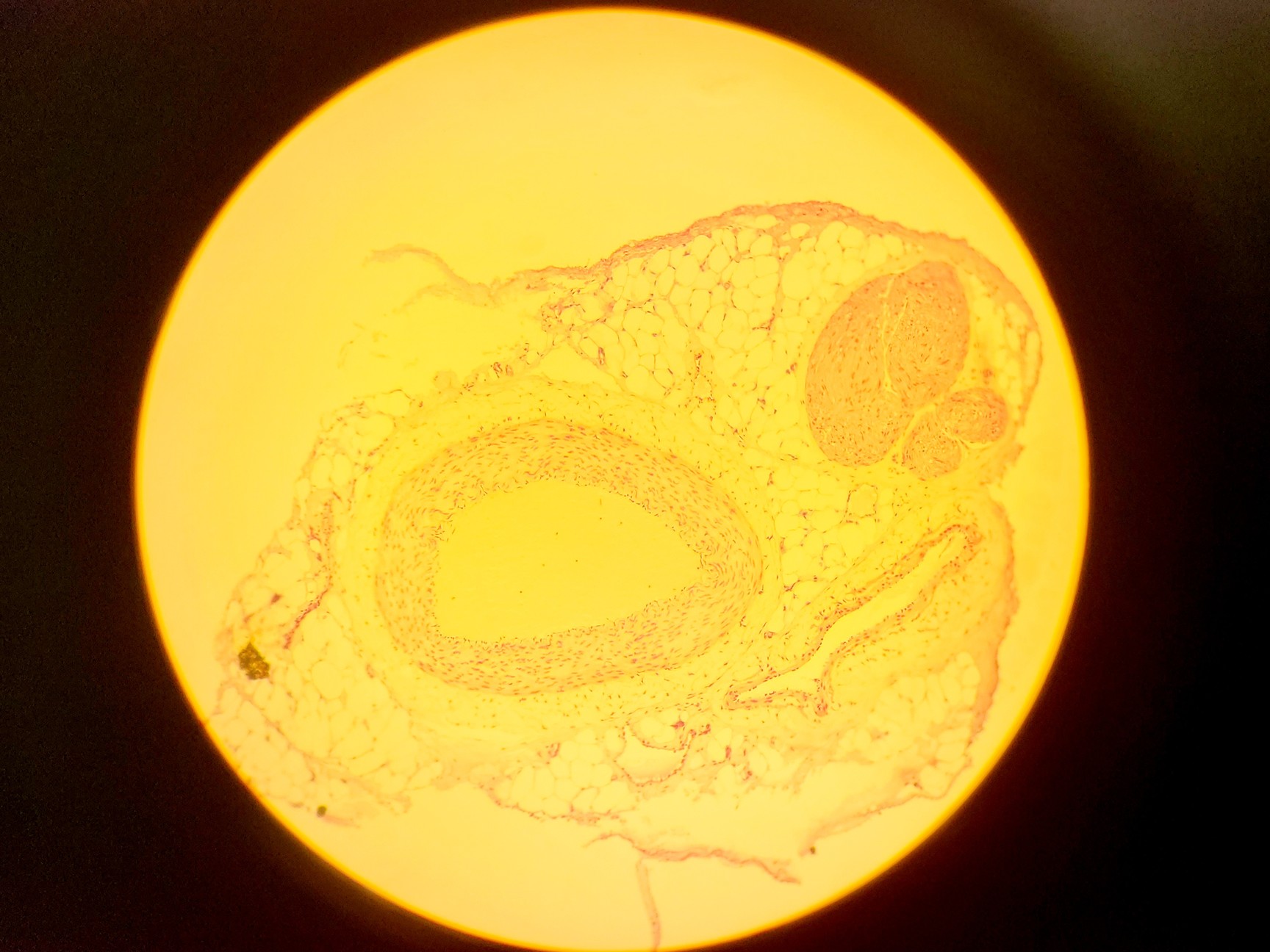 Image of Olympus BH-2 Compound Microscope w/ 5x Objectives DPlan SPlan A10PL