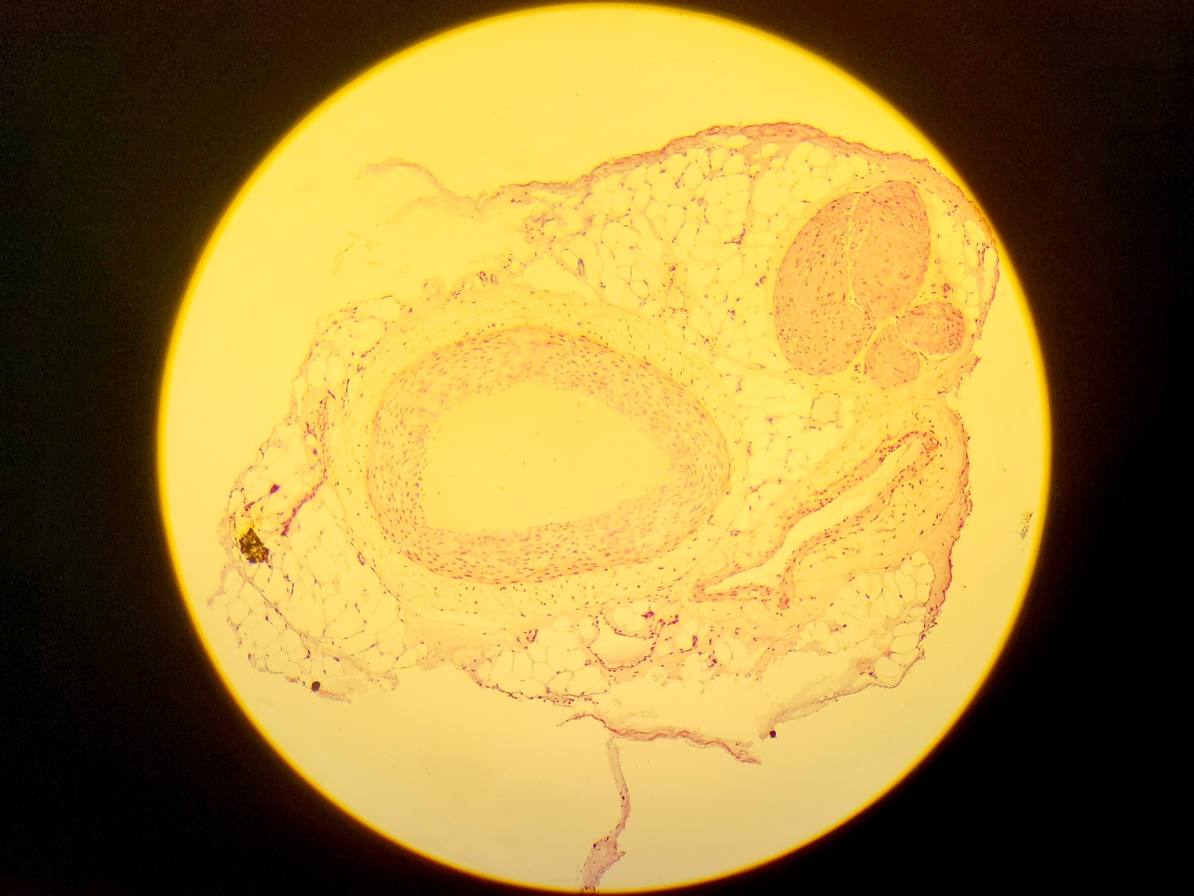 Image of Olympus BH-2 Compound Microscope w/ 5x Objectives DPlan SPlan A10PL