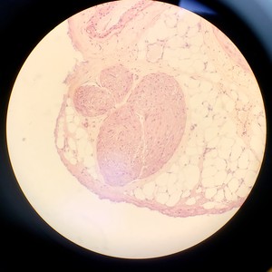 Thumbnail image of Leica DMIRB Microscope w/ COOL LED pE-4000 Light Source & Q Imaging Retiga 3000