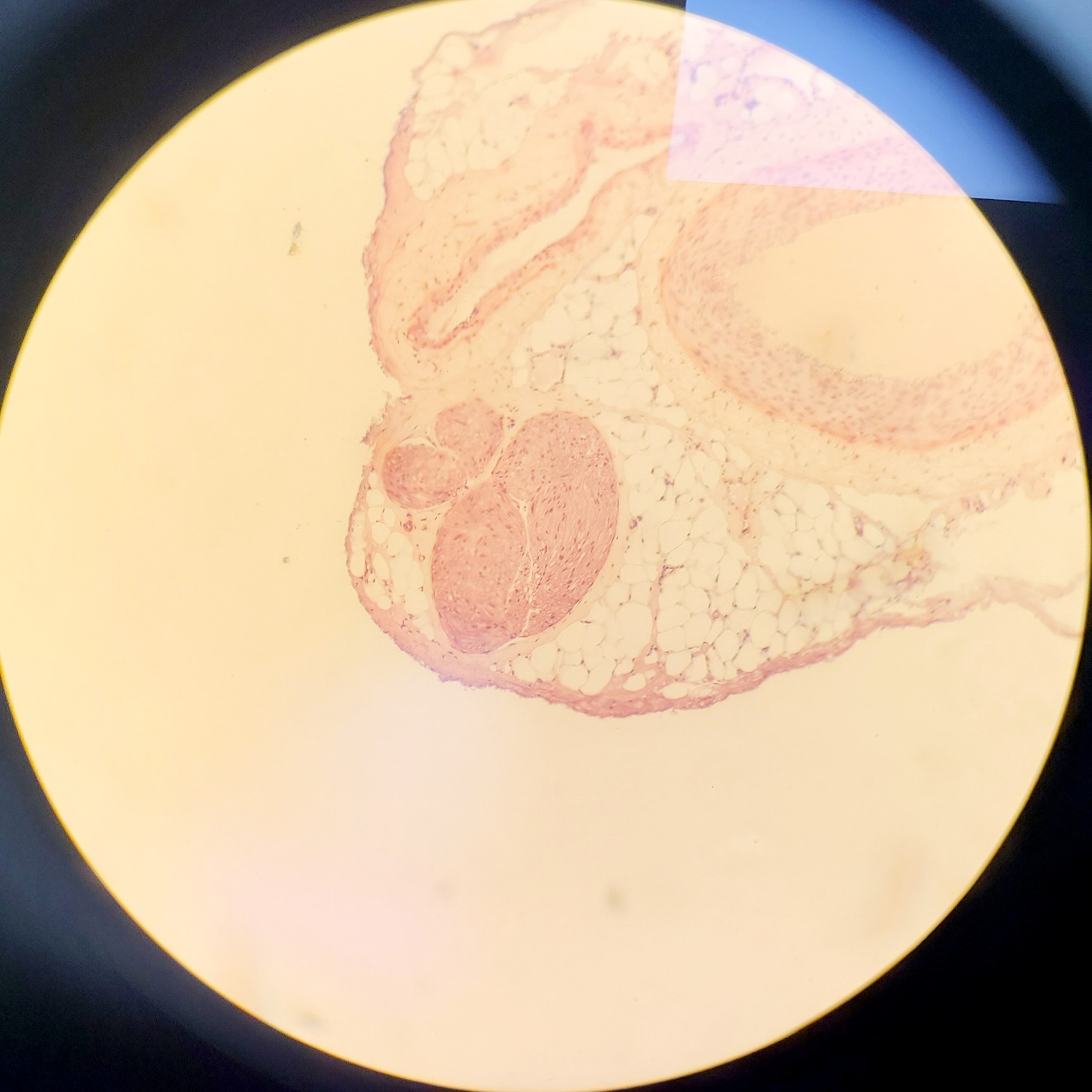 Image of Leica DMIRB Microscope w/ COOL LED pE-4000 Light Source & Q Imaging Retiga 3000