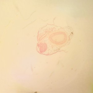 Thumbnail image of Leica DMIRB Microscope w/ COOL LED pE-4000 Light Source & Q Imaging Retiga 3000