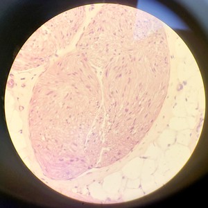 Thumbnail image of Leica DMIRB Microscope w/ COOL LED pE-4000 Light Source & Q Imaging Retiga 3000