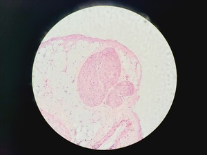 Thumbnail image of Olympus BX51 Fluorescence Microscope w/ CoolLED pE-300 Illumination Unit