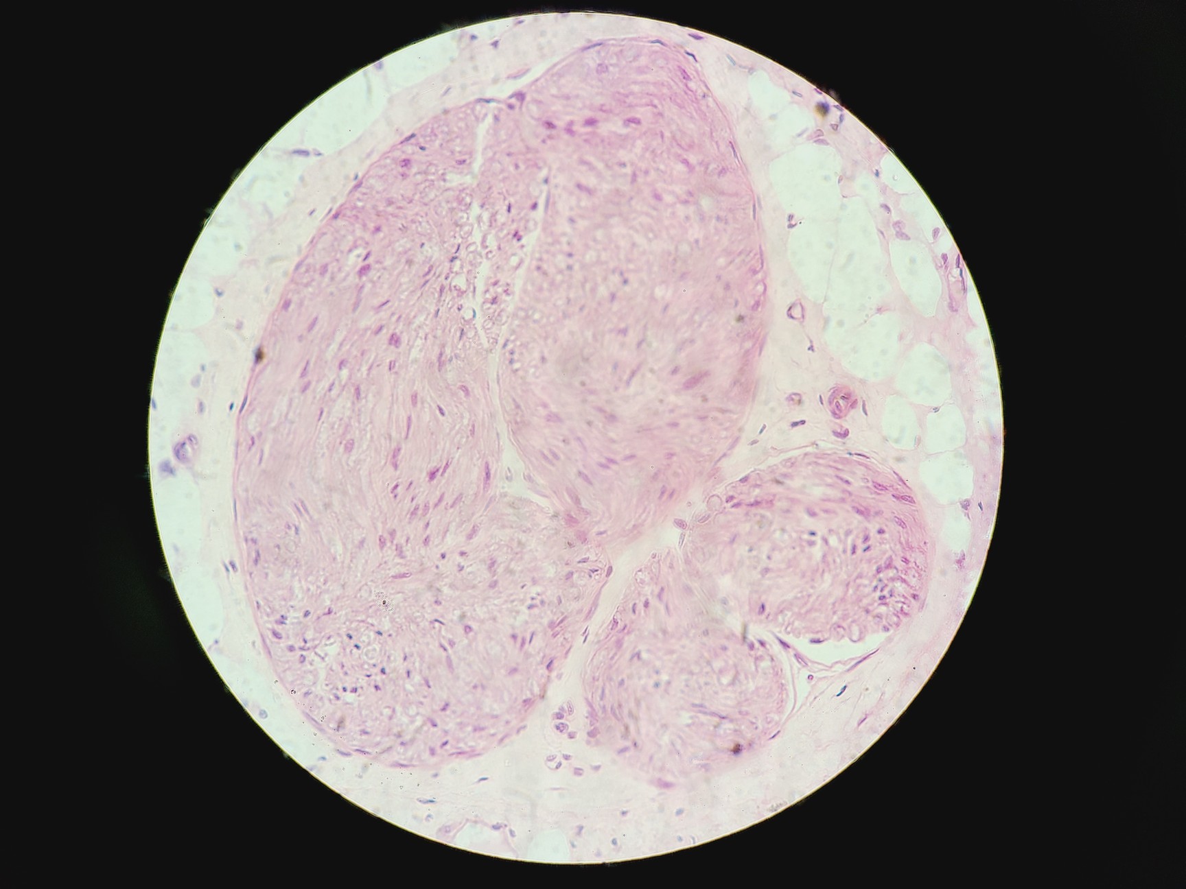 Image of Olympus BX51 Fluorescence Microscope w/ CoolLED pE-300 Illumination Unit