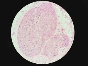 Thumbnail image of Olympus BX51 Fluorescence Microscope w/ CoolLED pE-300 Illumination Unit