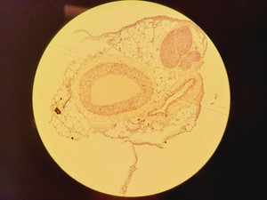 Thumbnail image of Nikon Eclipse Ni-U Compound Microscope w/ 6 x Objectives 2/4/10/20/40/100x Lab