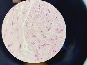 Thumbnail image of Nikon Eclipse Ni-U Compound Microscope w/ 6 x Objectives 2/4/10/20/40/100x Lab