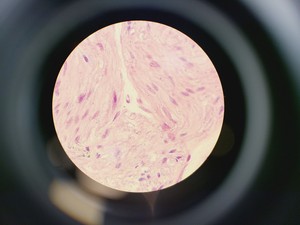 Thumbnail image of Nikon Optiphot Microscope w/ Microflex HFX-II & FX-35A Attachments