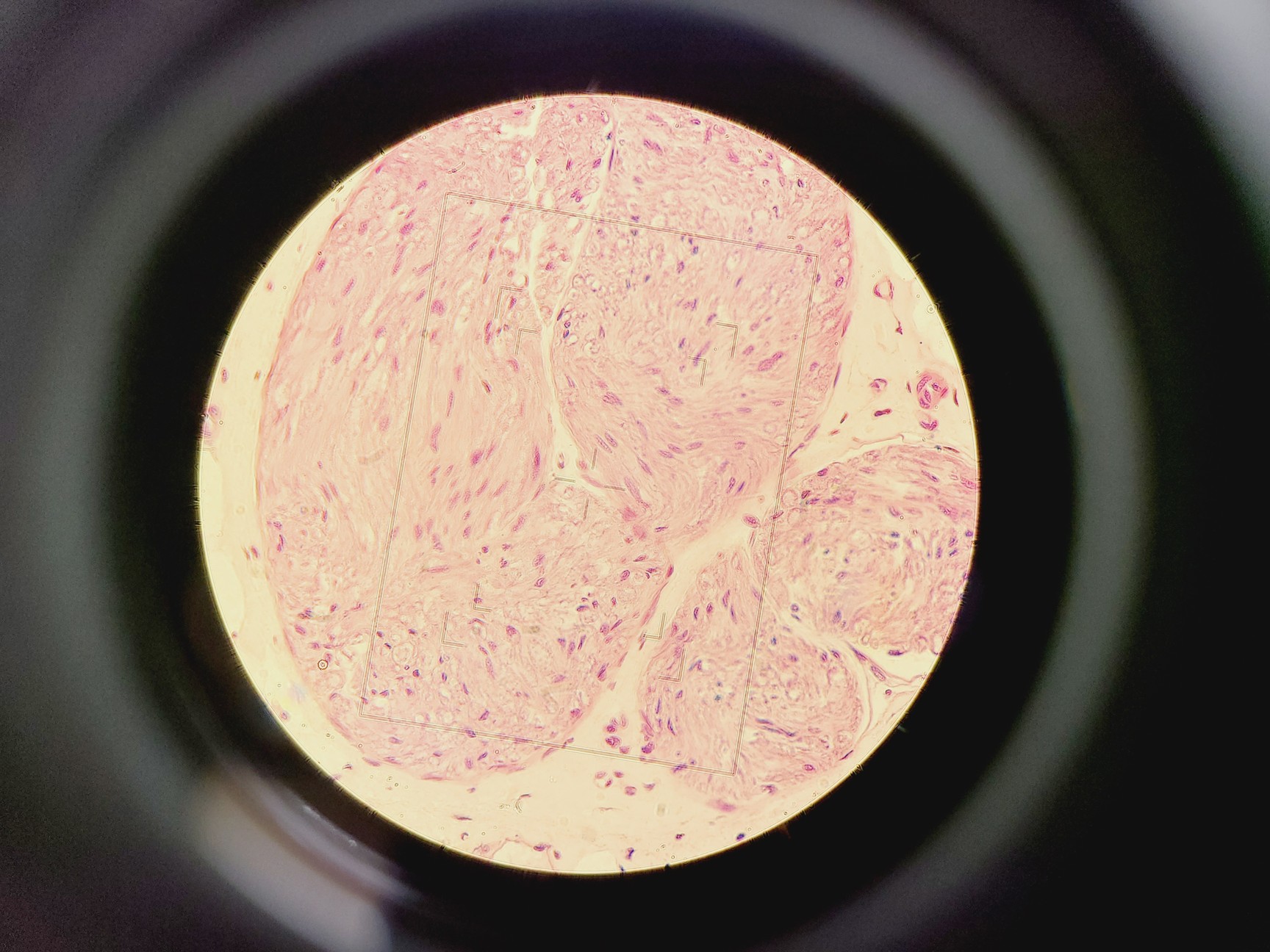 Image of Nikon Optiphot Microscope w/ Microflex HFX-II & FX-35A Attachments