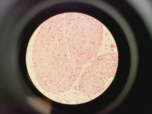 Thumbnail image of Nikon Optiphot Microscope w/ Microflex HFX-II & FX-35A Attachments