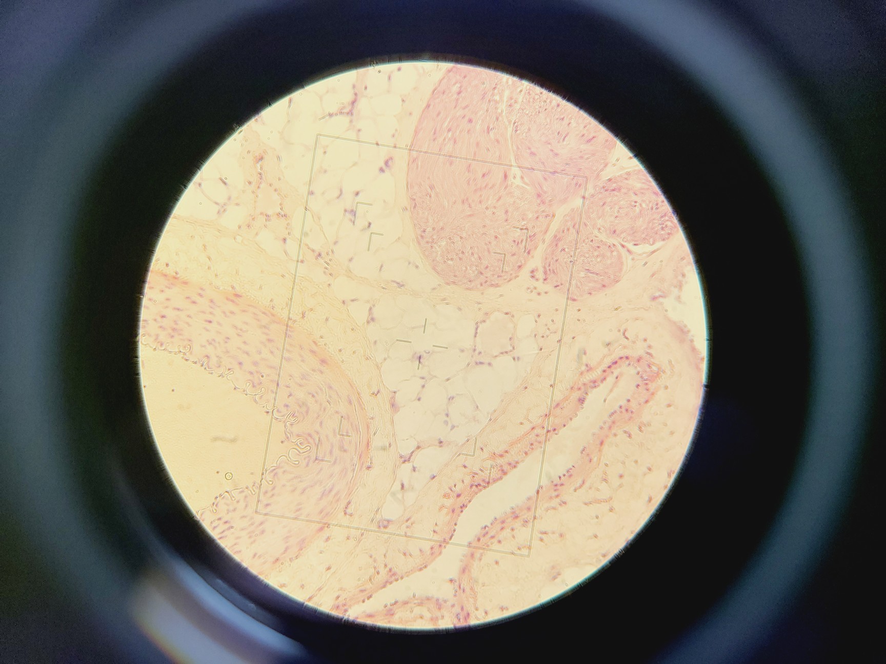 Image of Nikon Optiphot Microscope w/ Microflex HFX-II & FX-35A Attachments