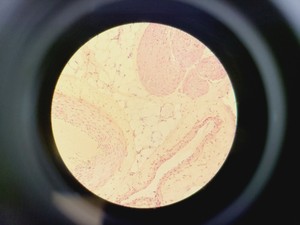 Thumbnail image of Nikon Optiphot Microscope w/ Microflex HFX-II & FX-35A Attachments