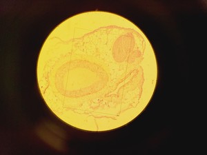 Thumbnail image of Nikon Optiphot Microscope w/ Microflex HFX-II & FX-35A Attachments