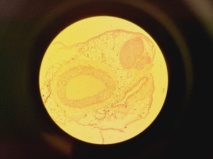 Thumbnail image of Nikon Optiphot Microscope w/ Microflex HFX-II & FX-35A Attachments