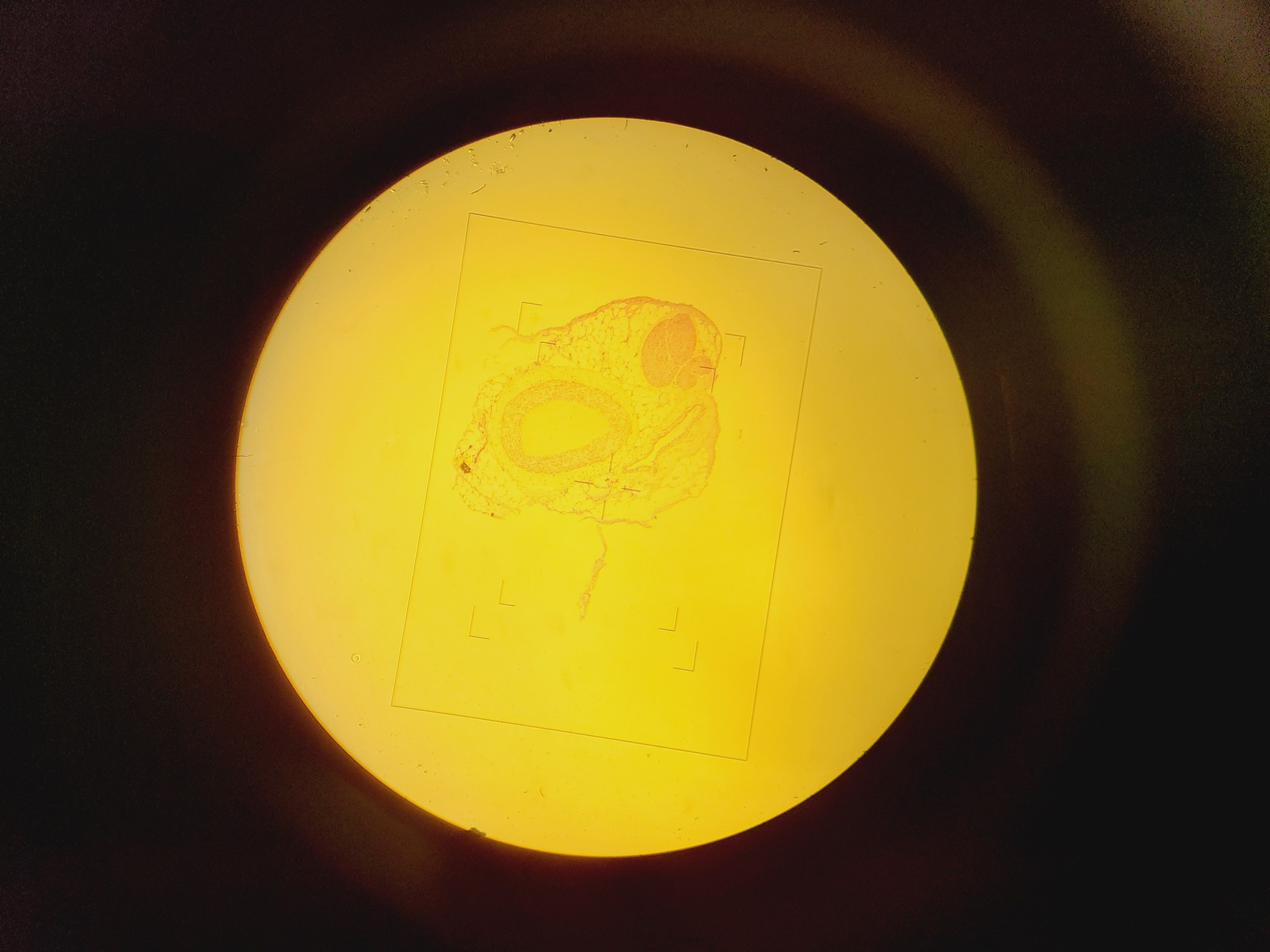 Image of Nikon Optiphot Microscope w/ Microflex HFX-II & FX-35A Attachments